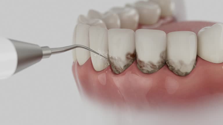 Reliable Tooth Extraction contractor in Beeville, TX by Smile Center Dentistry
